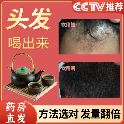 【养血生发茶】央视频推荐中药材