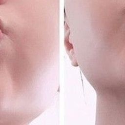 2025新款隐形鼻梁增高器美鼻垫隐形翘鼻挺鼻夹缩小鼻翼矫正器黑色