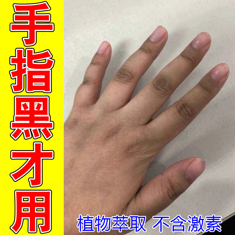 手指黑手指关节黑色素沉淀专用指关节暗沉粗糙手部角质堆积修护膏