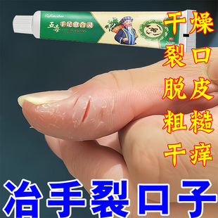 手裂口干裂修复霜秋冬季指甲缝干裂手指脱皮开裂手足干裂防裂膏