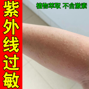 紫外线过敏冶身上粗糙红肿起水泡疙瘩起疹子老人身上痒晚上睡不着