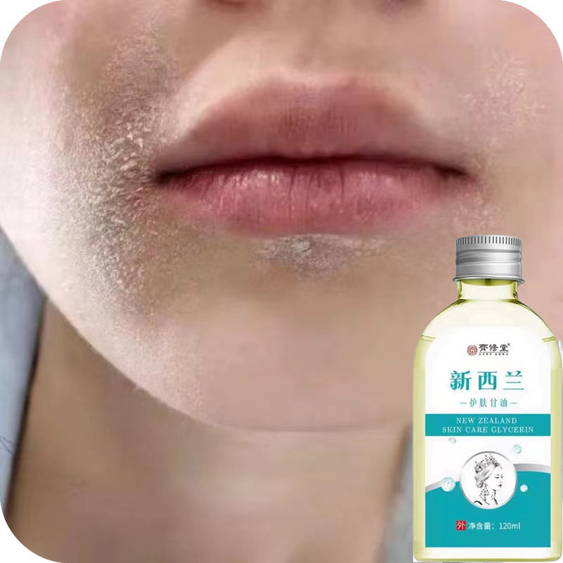 冶脸颊干燥爆皮脸上长干皮脸痒秋冬季皮肤过敏起皮干痒脸干起皮屑