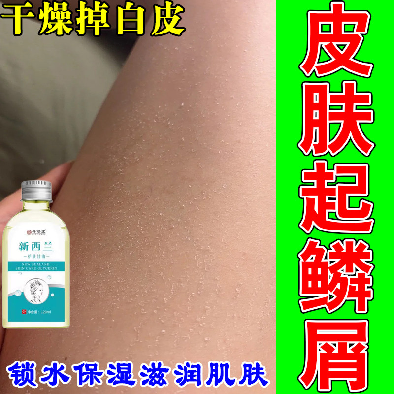 冶腿上干燥起皮小腿皮肤白屑粗糙干裂成人身上掉皮屑干皮甘油