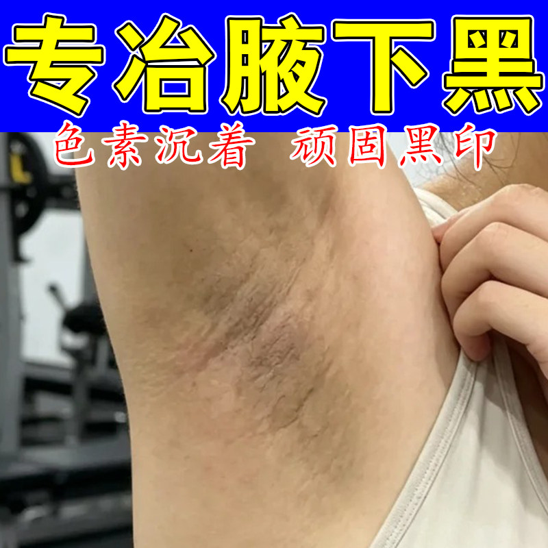 去腋下黑腋窝黑棘皮去胳肢窝黑色素沉淀腋下粗糙发黑按摩膏