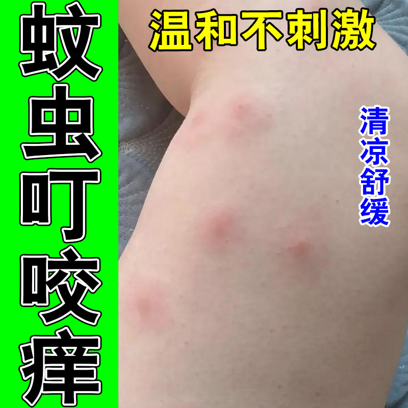 蚊虫叮咬跳蚤咬红痒虫蚊子叮咬红肿儿童成人皮肤过敏修护草本喷剂