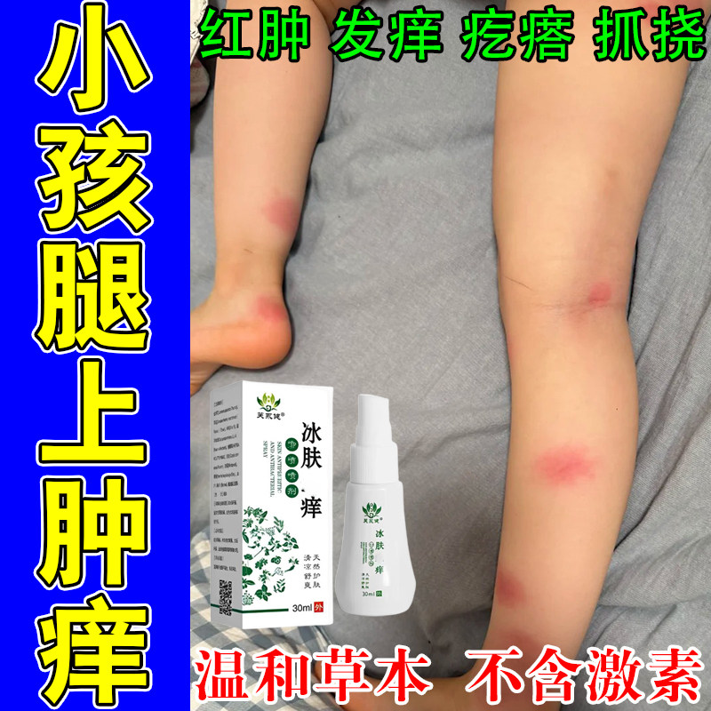 孩子身上疙瘩痒红肿抓挠蚊虫叮咬性过敏红肿长痘修护植物喷剂