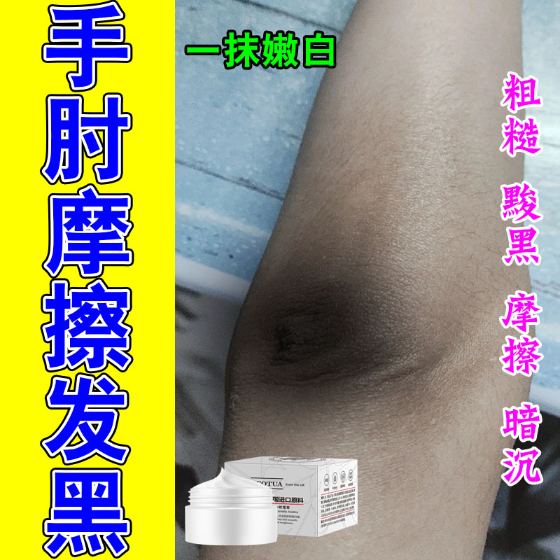 胳膊肘去全身黑皮手关节膝盖手肘皮肤黑色素沉淀发黑淡化按摩膏