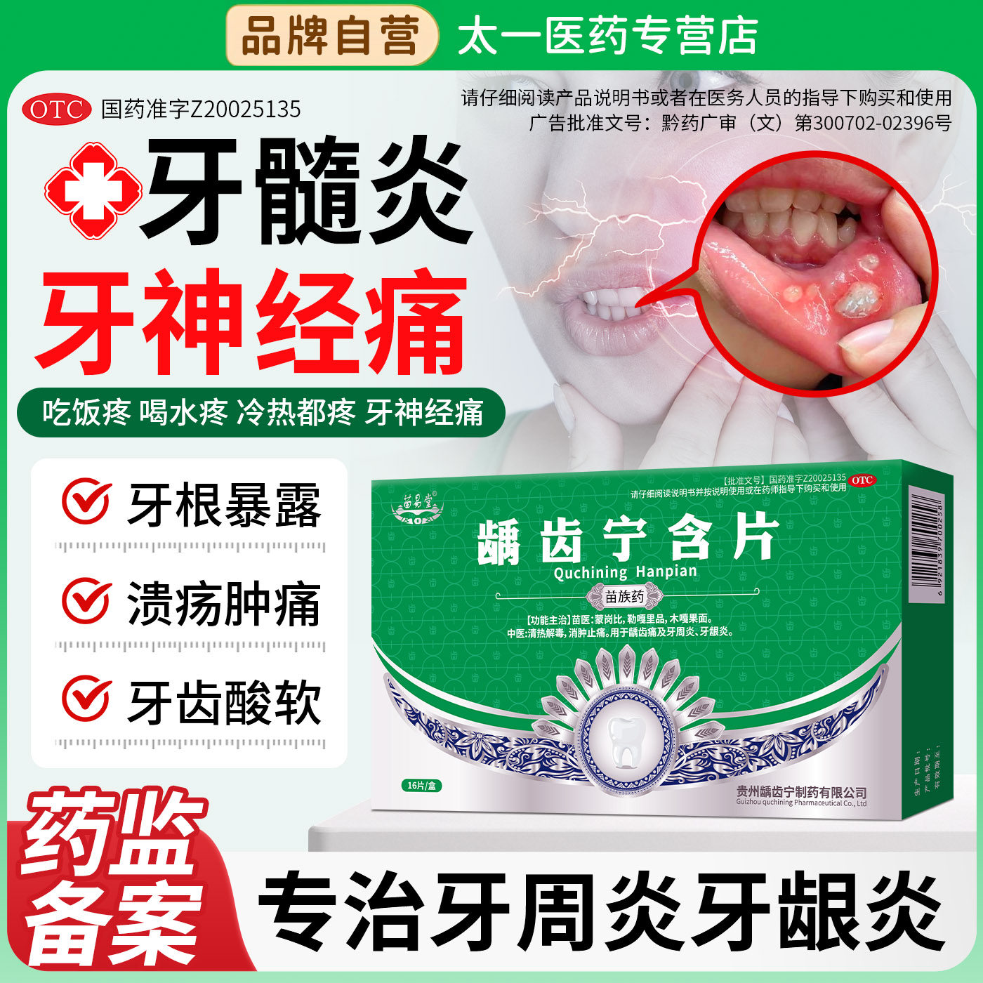 苗易堂龋齿宁含片牙痛药牙龈出血肿痛溃疡消炎止痛牙周髓炎龋齿痛