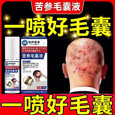 龙野苦参毛囊液头皮护理
