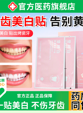 牙齿美白贴QHF片黄白临时遮盖门去牙缝丑变白白正品炫一次性自己