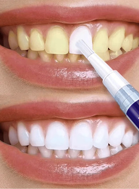 BAJK~牙渍可擦除~黑色烟渍~茶渍~去牙菌斑咖啡渍牙齿变白