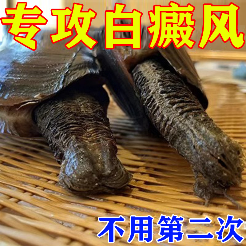 越严重越有用】白癜风外用膏黑色素生长快速消白斑除裉特效