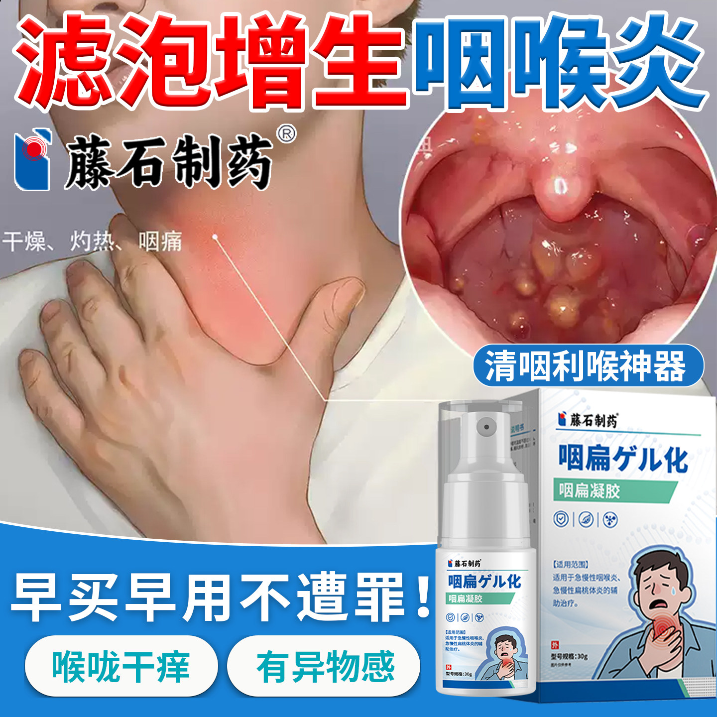 滤泡增生咽炎神器咽喉炎喷雾剂慢性咽炎专用舌根喉咙发炎异物感XP