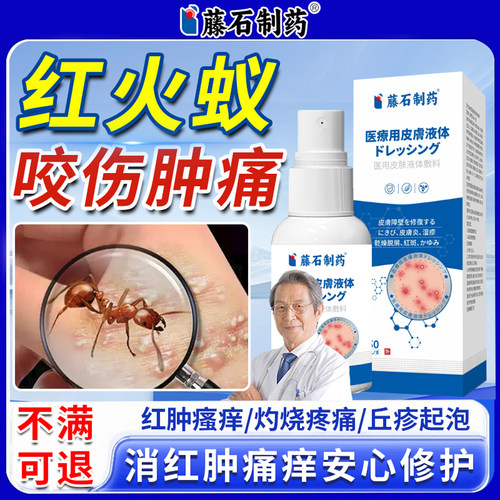 红火蚁咬伤蚂蚁蚊虫叮咬止痒消肿毒虫隐翅虫快速止痛专特用药膏XP