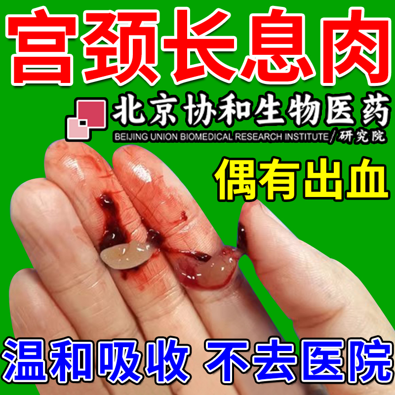 【北京协和生物】子宫内膜息肉