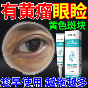 眼睑黄瘤眼部去除黄斑眼脸黄瘤膏眼皮睑黄疣眼贴神器药房同款膏yk