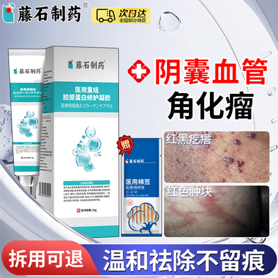 阴囊血管角化瘤私处红黑疙瘩蜘蛛痣红斑肿块出血阴囊湿疹黑点XP