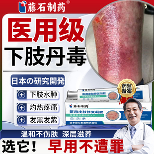 丹毒专用消肿软膏小腿红斑疼痛修复治疗下肢红肿灼热可搭膏药贴XP