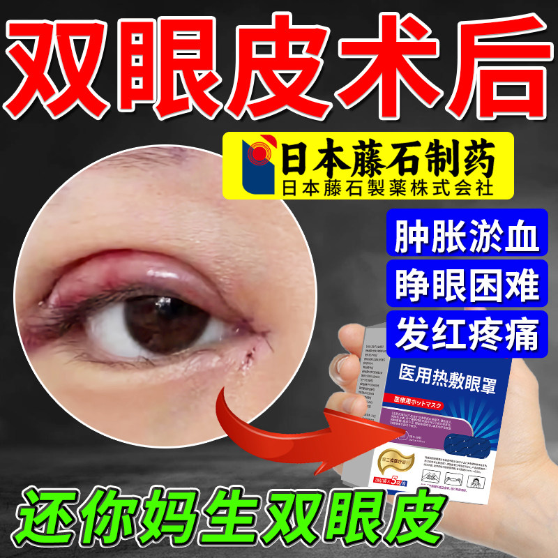 割双眼皮术后热敷蒸汽眼罩护理热敷贴消肿神器医用防增生肿胀疼XP