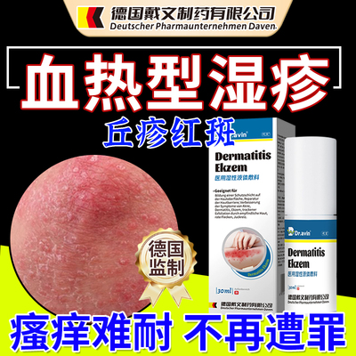 血热型湿疹瘙痒红疹专用无校退