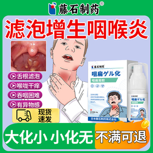 滤泡增生咽炎神器咽喉炎喷雾剂慢性咽炎专用舌根喉咙发炎异物感XP