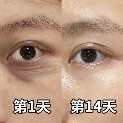 【推荐】再见眼角纹 淡化黑眼圈 收缩眼袋提拉眼部男女通用