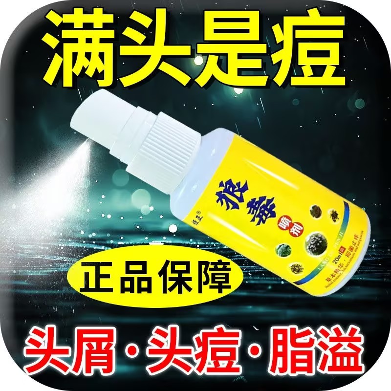 狼毒头藓头皮屑头皮痒头皮发红长疙瘩红斑狼毒喷剂头藓头皮藓
