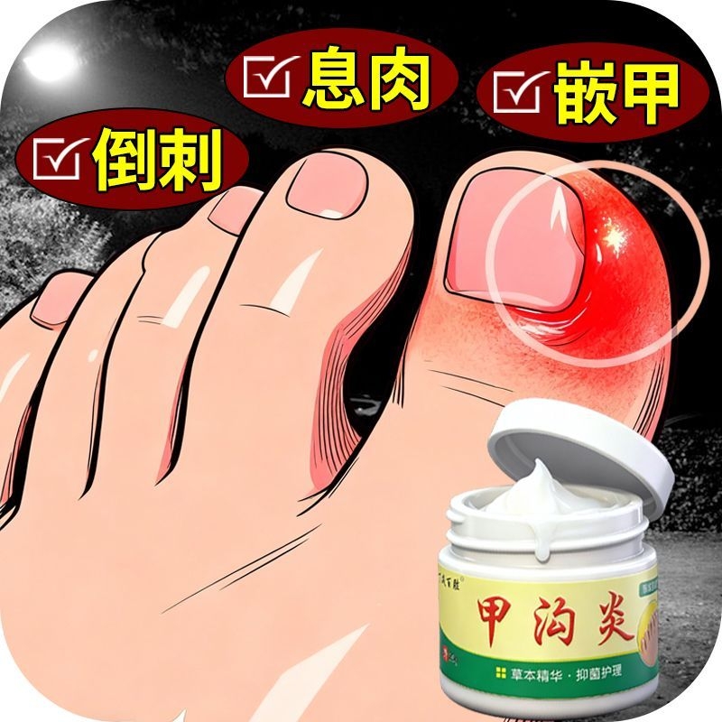 甲沟焱脚指甲疼大拇指往肉里长销肿感染发焱红肿化脓脚指甲止痛膏