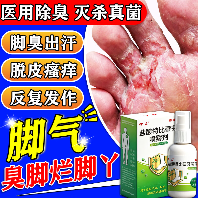 盐酸特比萘芬喷雾剂正品脚气喷雾止痒脱皮杀菌脚痒烂脚丫真菌感染