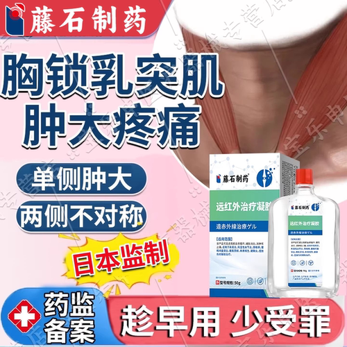 胸锁乳突肌单侧肿大疼痛