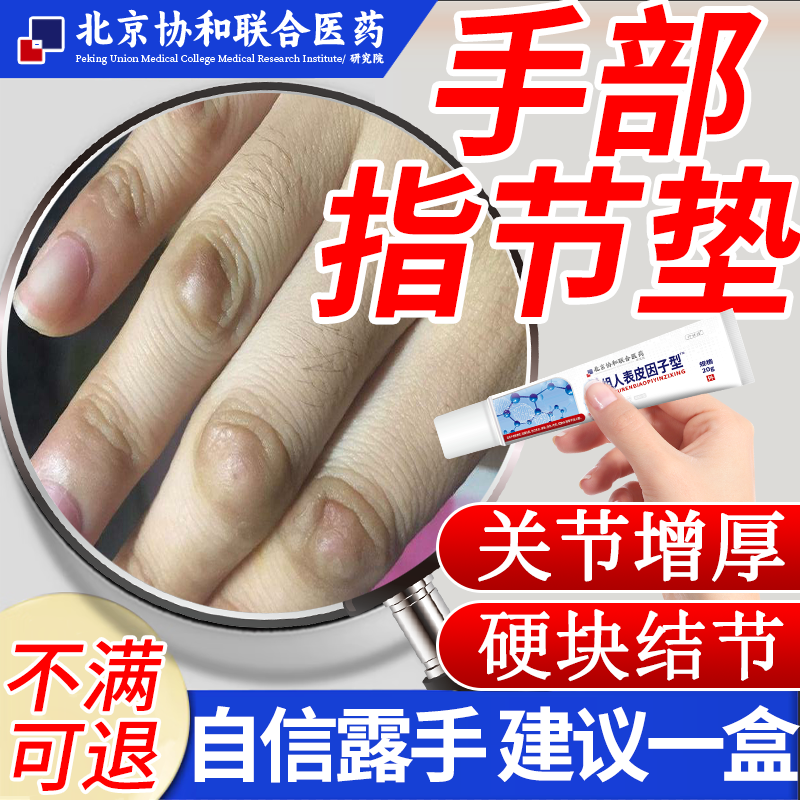 手部关节指节垫手上硬疙瘩关节变厚硬块结节粗糙硬皮可搭膏药贴vp