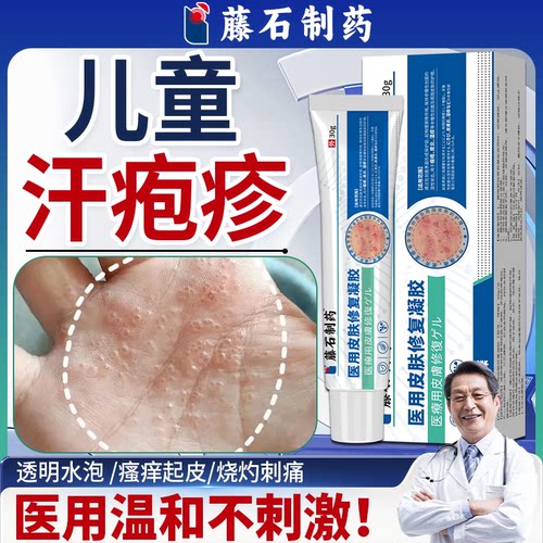 儿童手指汗疱疹医用膏