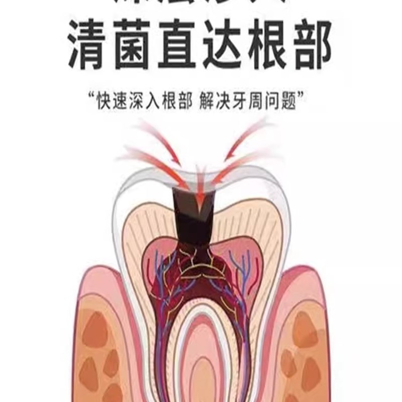速发【重度牙松可固】牙齿松动牙龈肿痛出血退缩牙痛牙晃动固齿牙