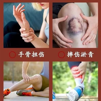 极速伤筋动骨膏药跌打损伤消肿化瘀外用摔K伤崴脚踝扭伤拉伤膏药