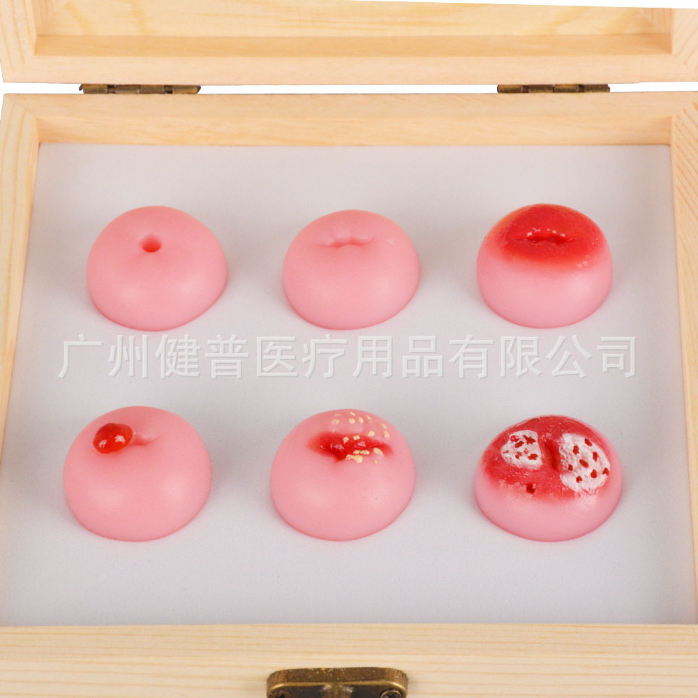 教学解说模型宫颈病理展示模型1-6级(木盒款)子宫模型宫颈模型