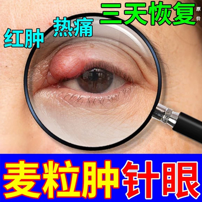 瑞珠萘敏维滴眼液过敏性结膜炎结膜充血眼疲劳发痒抗过敏收缩血管