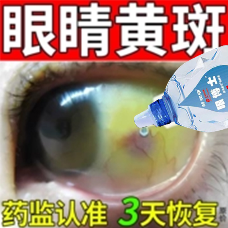 蓝梅叶黄素眼药水老花眼白内障黄斑病变干眼症状维持视网膜功能