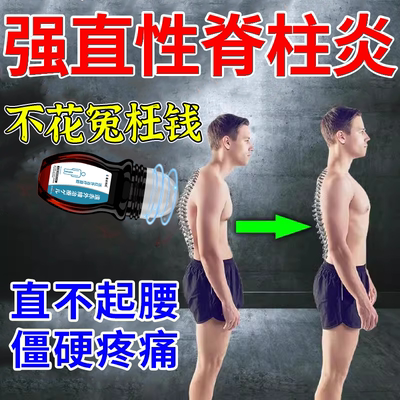 强直性脊柱炎专用贴生物制剂强制性脊椎炎痛骶髂关节炎膏矫正器HB