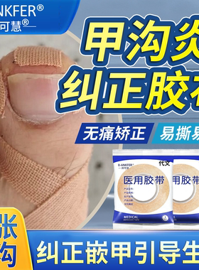 甲沟炎矫正胶带指甲矫正器嵌甲专用隔离脚趾甲长肉里BM