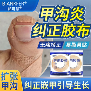 甲沟炎矫正胶带指甲矫正器嵌甲专用隔离脚趾甲长肉里HB