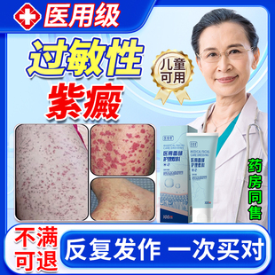 过敏性紫癜疗去色素皮下出血红点膏瘀皮炎血管炎儿童药监备案OM