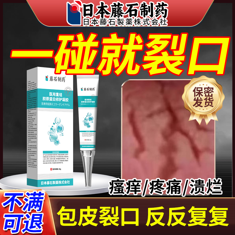 包皮炎症专用红肿开裂口发炎真菌感染白垢干破裂开龟头炎HV