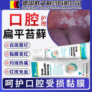 口腔扁平苔藓专用可搭牙膏修的复口腔黏膜白斑舌头溃疡疼纤维化K1
