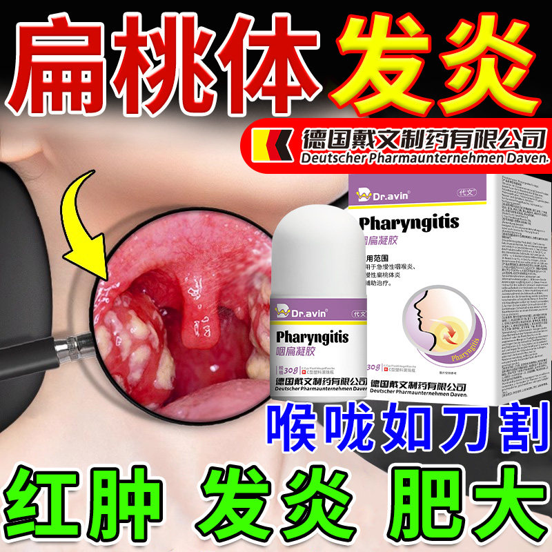 扁桃体发炎喉咙肿痛儿童嗓子疼扁桃体肿大专用喷剂叫监备案HB