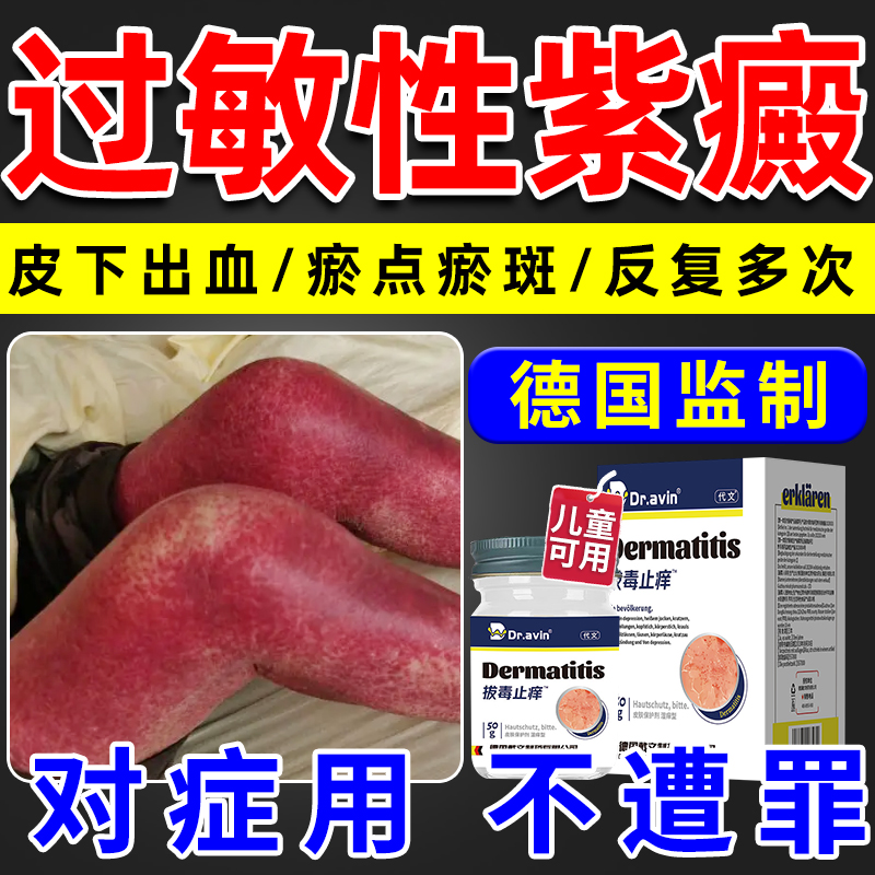 过敏性紫癜治疗色素皮下出血红点瘀点瘀斑皮炎血管炎儿童药hb