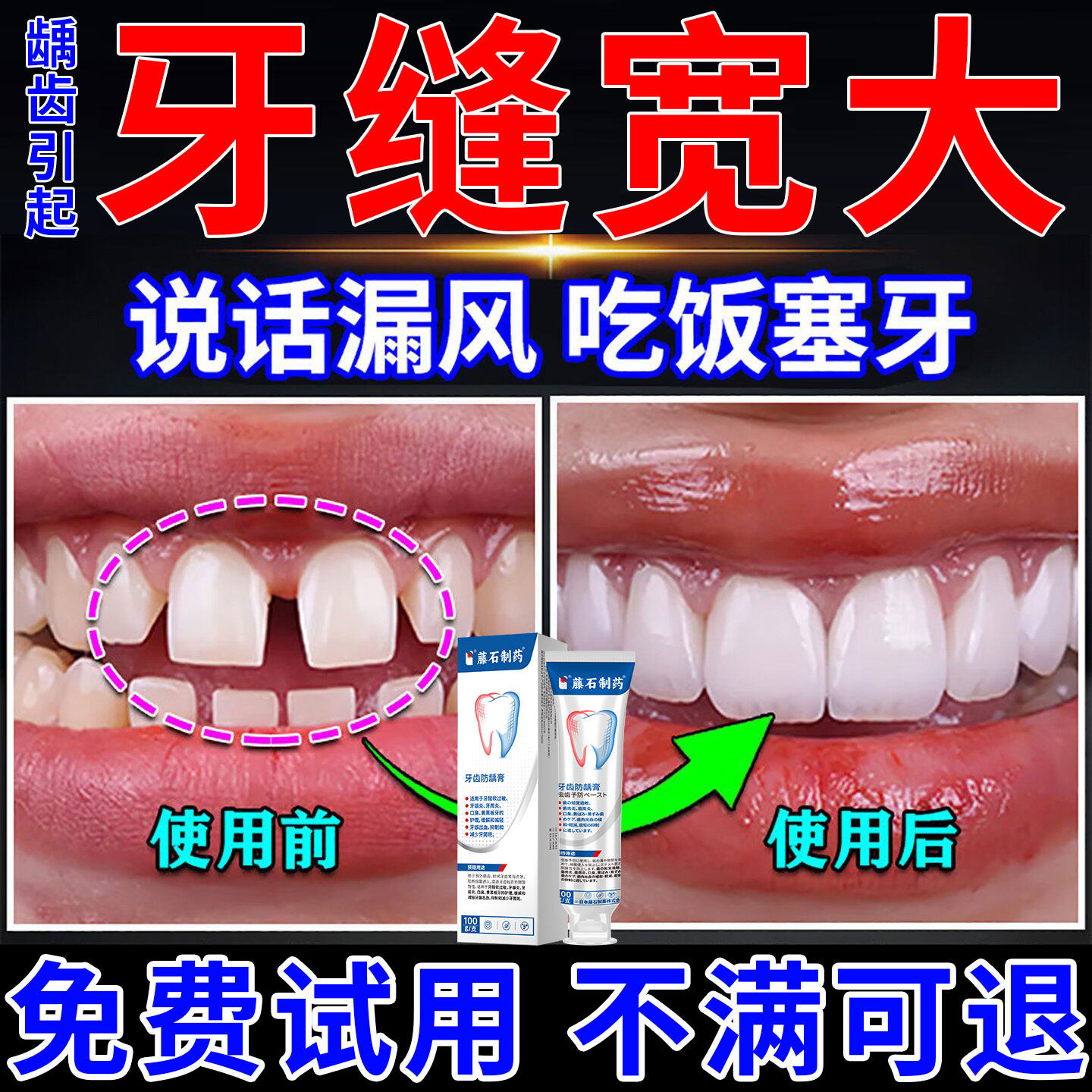 牙缝宽大修神器复补牙缝填充牙疼牙龈萎缩修松动复专用可搭牙膏OM