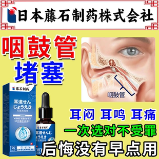 咽鼓管堵塞耳闷耳鸣耳聋专用滴耳液中耳炎积液发炎流脓药房同款FJ