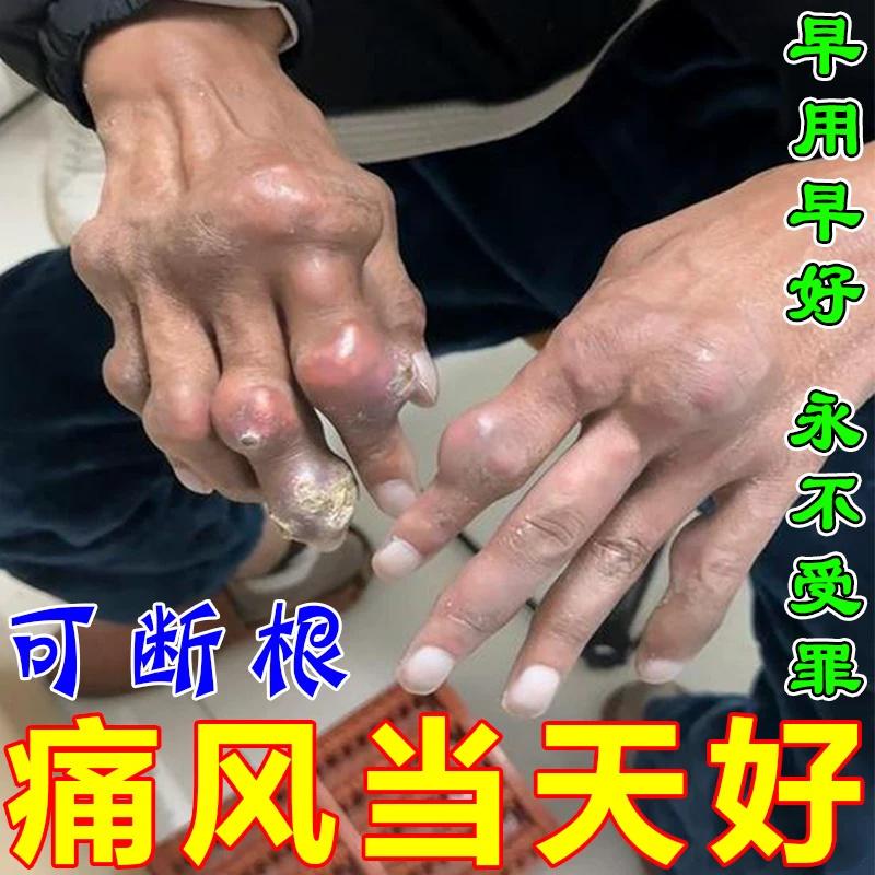 宝叶堂追风膏日本关节痛药痛风膏治疗腰腿疼痛祛风散寒活血止痛