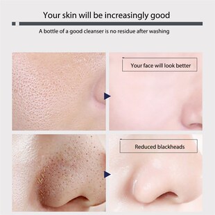 极速Face Cleanser Blackhead Remover FFace Cleaner Face Care