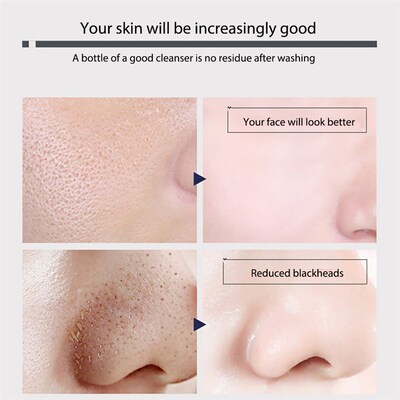 极速Face Cleanser Blackhead Remover FFace Cleaner Face Care